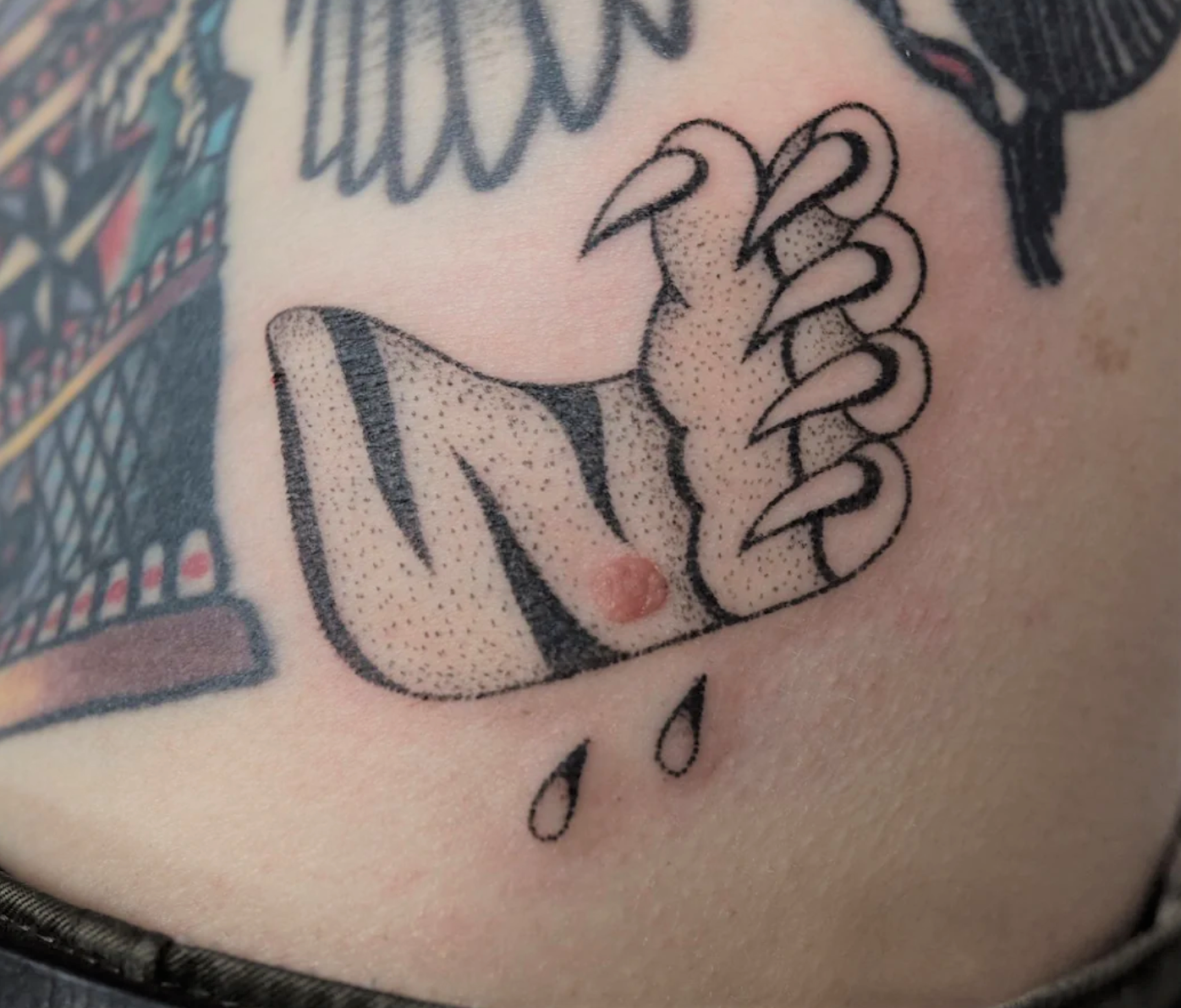 Tattoo around a mole